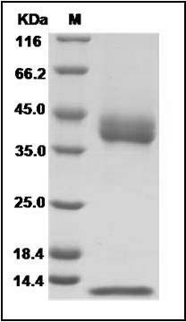 Human CD1B & B2M Heterodimer Protein SDS-PAGE