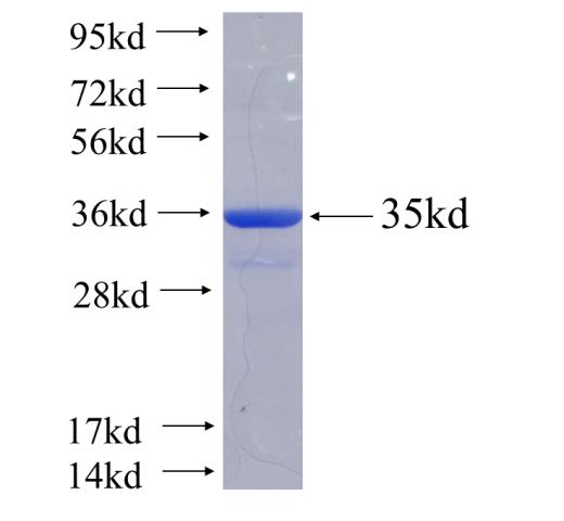 Recombinant human SNX10 SDS-PAGE