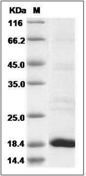 Human Flavokinase / RFK Protein (His Tag) SDS-PAGE