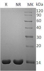 Human IL2 recombinant protein