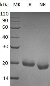 Human SECTM1/K12 (His tag) recombinant protein