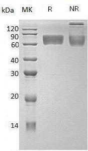 Human SLC3A2/MDU1 (His tag) recombinant protein