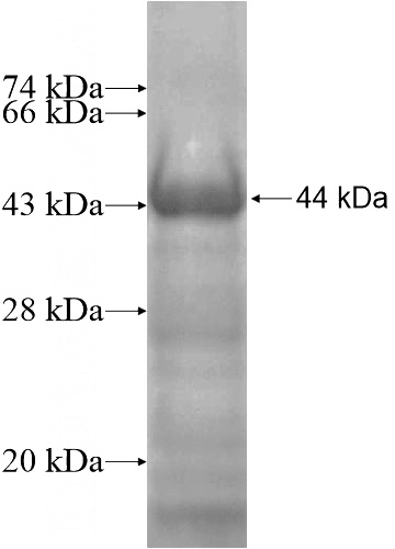 Recombinant Human C16orf70 SDS-PAGE