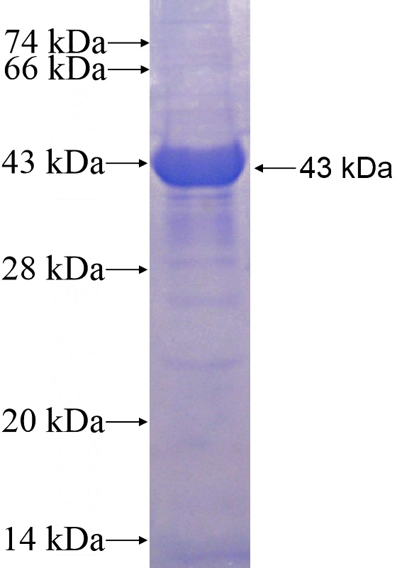 Recombinant Human BMP3 SDS-PAGE