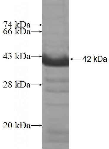 Recombinant Human ADD2 SDS-PAGE
