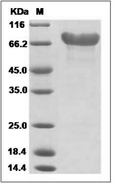 Mouse CD320 / 8D6A Protein (Fc Tag) SDS-PAGE