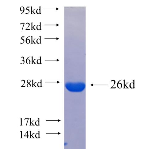 Recombinant human PTP4A1(Full length) SDS-PAGE