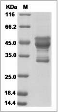 Human ARL6IP6 Protein (Fc Tag) SDS-PAGE