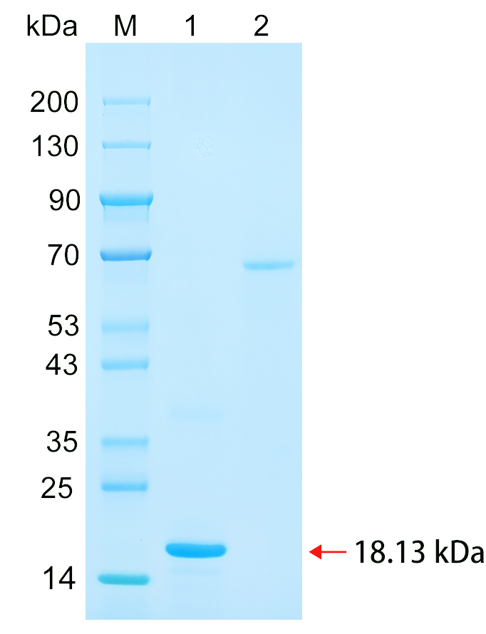 Recombinant ZN644 protein (His tag) SDS-PAGE