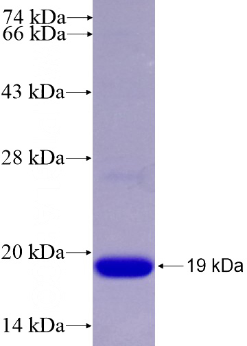 Recombinant Human RPL30 SDS-PAGE
