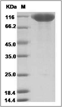Human Siglec-2 / CD22 Protein (His Tag) SDS-PAGE