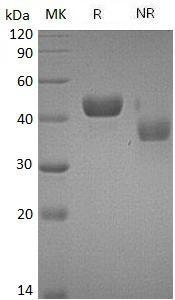 Mouse Ca14/Car14/Catm (His tag) recombinant protein