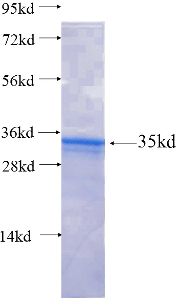Recombinant Human EDEM3 SDS-PAGE