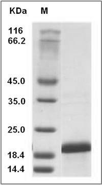 Human IL36B / IL1F8 Protein (His Tag) SDS-PAGE