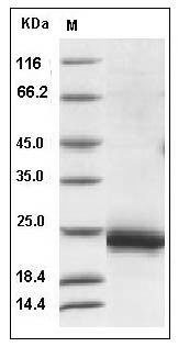 Rat IL3 / interleukin 3 Protein (His Tag) SDS-PAGE