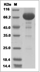 Rat IL12B / IL-12B Protein (Fc Tag) SDS-PAGE