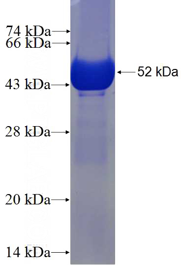 Recombinant Human GSTA2 SDS-PAGE