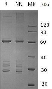 Human GTF2B/TF2B/TFIIB (GST tag) recombinant protein