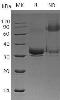 Mouse Mstn/Gdf8 (His tag) recombinant protein
