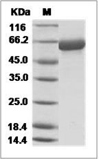 Influenza A H13N8 (A/black-headed gull/Netherlands/1/00) Hemagglutinin / HA Protein (His Tag)