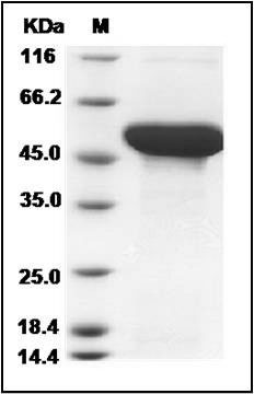 Human ADSL / Adenylosuccinate Lyase Protein (His Tag) SDS-PAGE