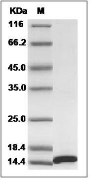 Mouse FABP4 / ALBP / A-FABP / AFABP Protein (His Tag) SDS-PAGE