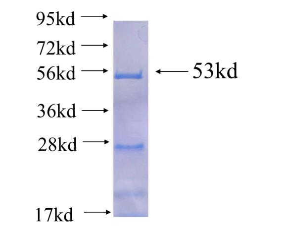 Recombinant Arabidopsis thaliana XK-1 SDS-PAGE