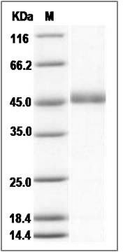 Vaccinia Virus B18R Protein (His Tag) SDS-PAGE