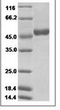 ZIKV Nonstructural protein 1 / Zika-NS1 Protein 14969