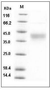Human CD48 / SLAMF2 / BCM1 Protein (His Tag) SDS-PAGE