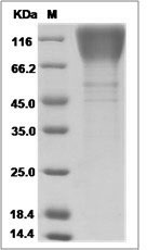 HIV-1 (group M, subtype A, isolate 92RW020) Envelope glycoprotein gp160 Protein (gp120 subunit) (His Tag)