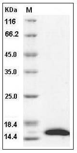 Human CRABP2 Protein (His Tag) SDS-PAGE