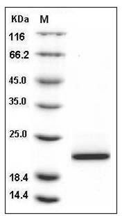 Human Cyclophilin B / PPIB / CYPB Protein (His Tag) SDS-PAGE