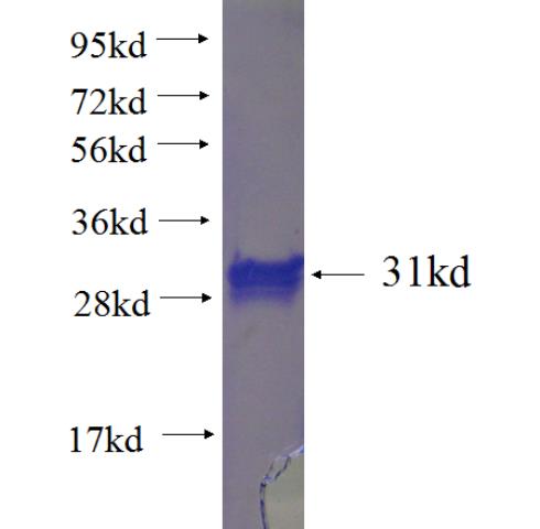 Recombinant human ACTN3 SDS-PAGE