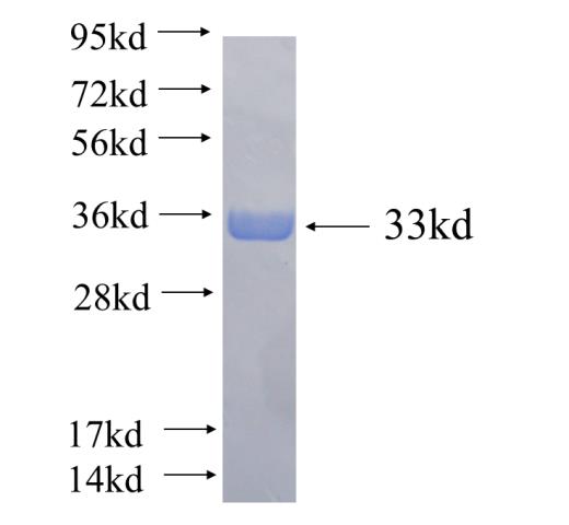 Recombinant human ST13 SDS-PAGE