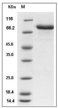 Mouse MFI2 / CD228 / melanotransferrin Protein (His Tag) SDS-PAGE