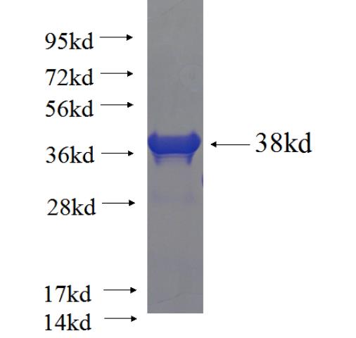 Recombinant human RPTN SDS-PAGE