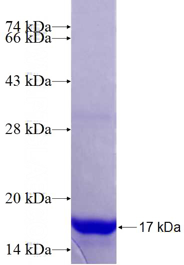 Recombinant Human ACN9 SDS-PAGE