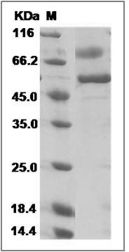 Human SARS Coronavirus Spike Protein (Receptor Binding Domain, Fc Tag) SDS-PAGE