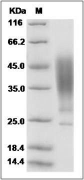 Human ORM2 Protein (His Tag) SDS-PAGE