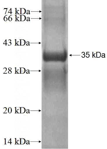 Recombinant Human ENOPH1 SDS-PAGE