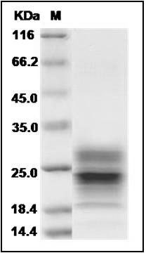 Ferret IFNG / Interferon Gamma Protein (His Tag) SDS-PAGE