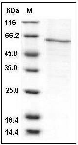Human AKT1 / PKB / PKB? Protein (His Tag) SDS-PAGE