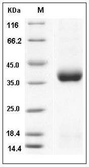 Mouse CLEC10A / MGL1 / CD301 Protein (His Tag) SDS-PAGE