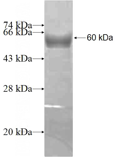 Recombinant Human LRRC4C SDS-PAGE