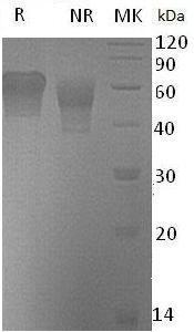 Human CD55/CR/DAF (His tag) recombinant protein