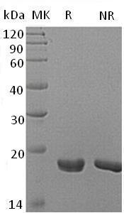 Human TXNDC12/TLP19/UNQ713/PRO1376 (His tag) recombinant protein