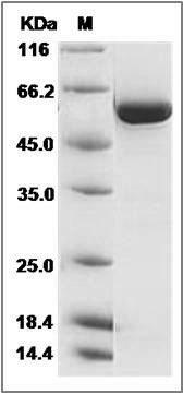 Human TGFBR1 / ALK-5 / SKR4 Protein (aa 200-503, His & GST Tag) SDS-PAGE