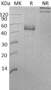 Human ICOS/AILIM (Fc tag) recombinant protein