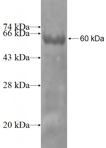 Recombinant Human IFRD1 SDS-PAGE